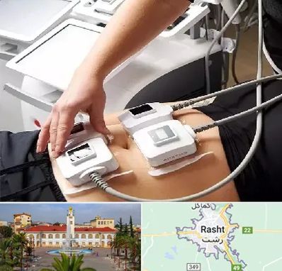 ترواسکالپ در رشت