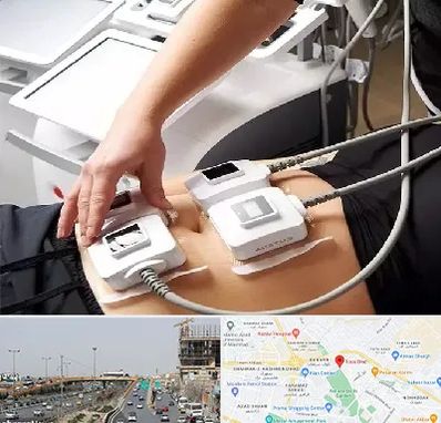 ترواسکالپ در بلوار توس مشهد 