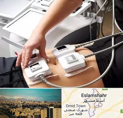 ترواسکالپ در اسلامشهر