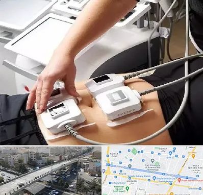 ترواسکالپ در فرجام