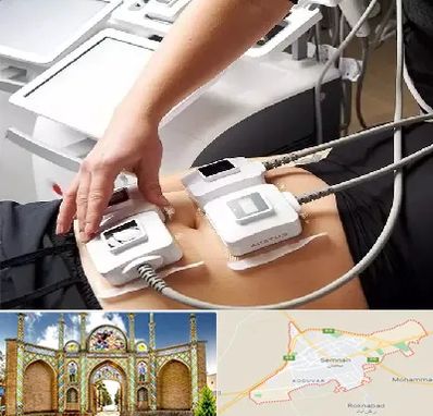 ترواسکالپ در سمنان