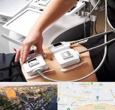 ترواسکالپ در تهرانپارس 