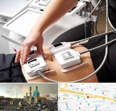 ترواسکالپ در رسالت 