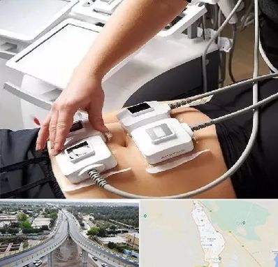 ترواسکالپ در اندیمشک