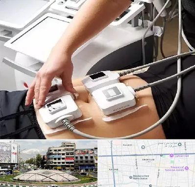 ترواسکالپ در مرکز تهران