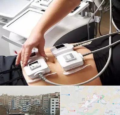 ترواسکالپ در محمد شهر کرج 