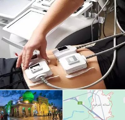 ترواسکالپ در آستانه اشرفیه