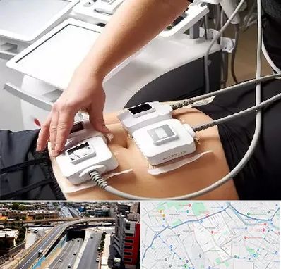 ترواسکالپ در ستارخان شیراز