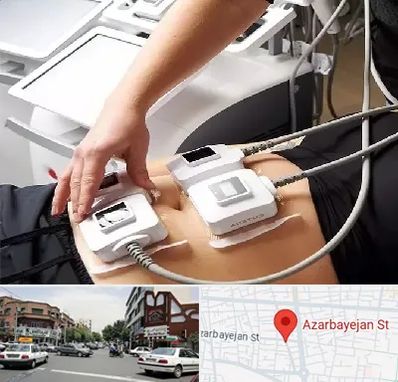 ترواسکالپ در خیابان آذربایجان