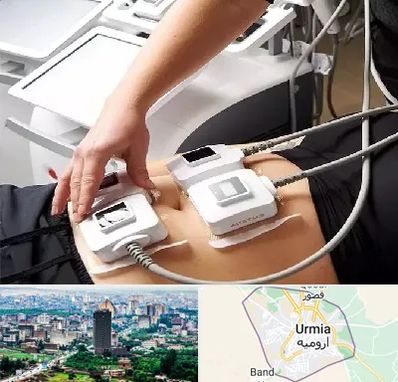 ترواسکالپ در ارومیه