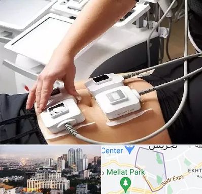 ترواسکالپ در الهیه 