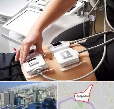 ترواسکالپ در محمودیه