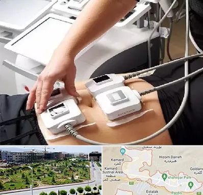 ترواسکالپ در پردیس