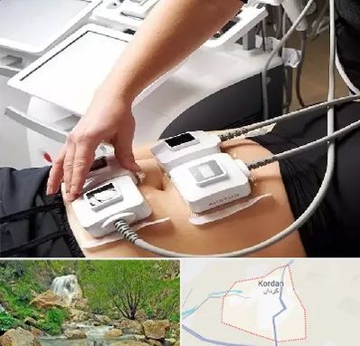 ترواسکالپ در کردان