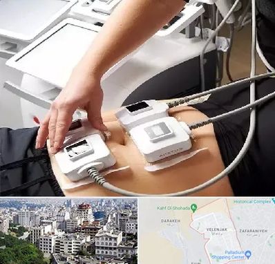 ترواسکالپ در ولنجک 