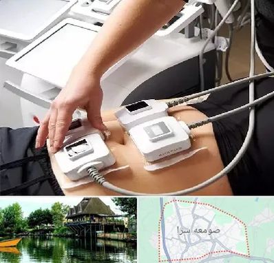 ترواسکالپ در صومعه سرا