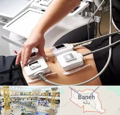 ترواسکالپ در بانه