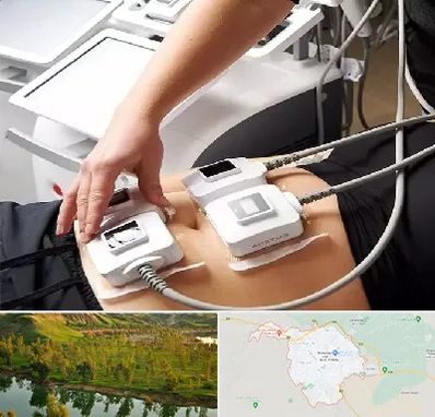 ترواسکالپ در بهبهان