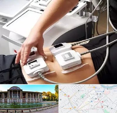 ترواسکالپ در عفیف آباد شیراز