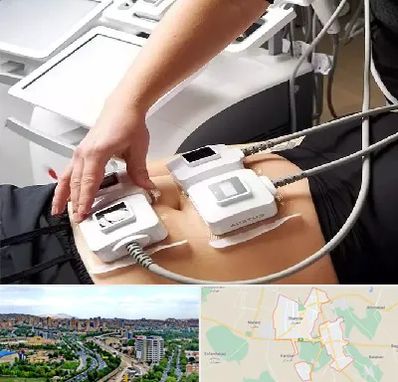 ترواسکالپ در شهریار