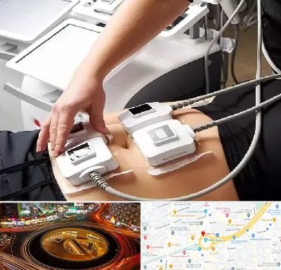 ترواسکالپ در میدان ولیعصر 