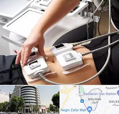 ترواسکالپ در قلهک 