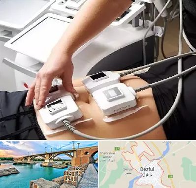 ترواسکالپ در دزفول