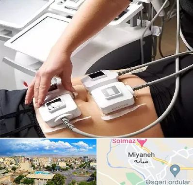 ترواسکالپ در میانه