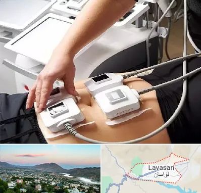 ترواسکالپ در لواسان