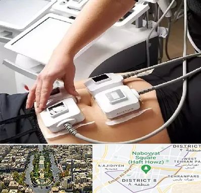 ترواسکالپ در نارمک 