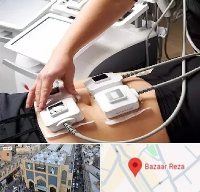 ترواسکالپ در بازار رضا مشهد