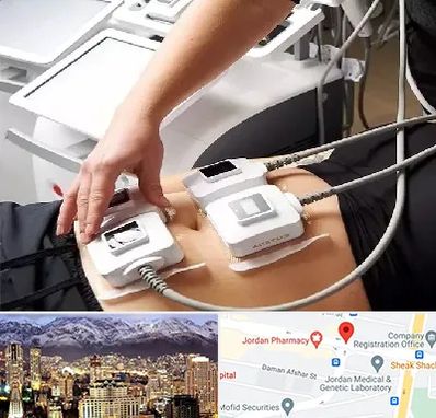 ترواسکالپ در جردن 