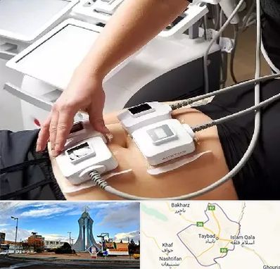 ترواسکالپ در تایباد