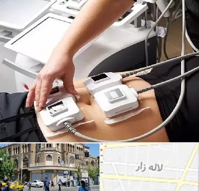 ترواسکالپ در لاله زار