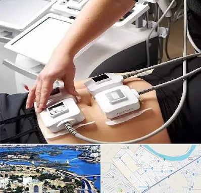 ترواسکالپ در کوروش اهواز