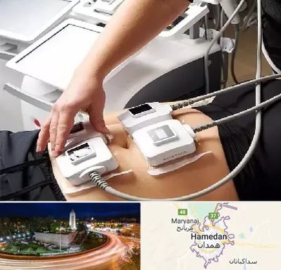 ترواسکالپ در همدان