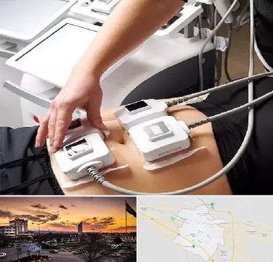 ترواسکالپ در قوچان