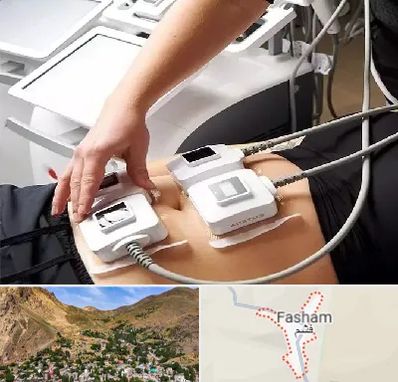 ترواسکالپ در فشم