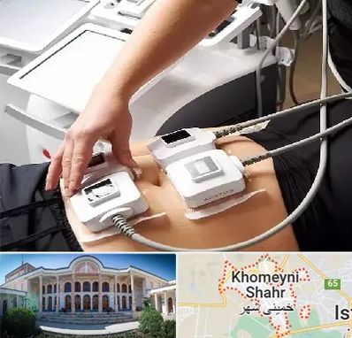 ترواسکالپ در خمینی شهر