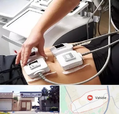 ترواسکالپ در وحیدیه شهریار