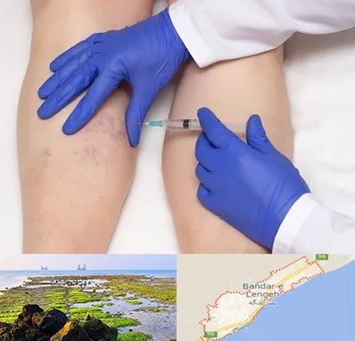 اسکلروتراپی در بندرلنگه