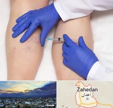 اسکلروتراپی در زاهدان