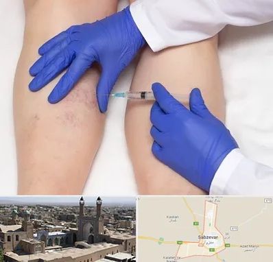 اسکلروتراپی در سبزوار