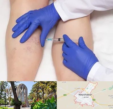 اسکلروتراپی در نیشابور