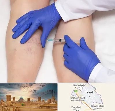 اسکلروتراپی در یزد