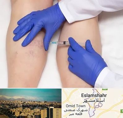 اسکلروتراپی در اسلامشهر