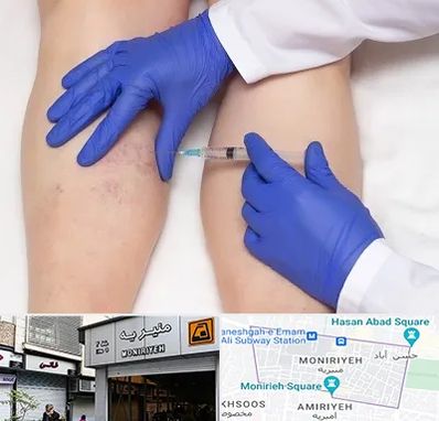 اسکلروتراپی در منیریه 