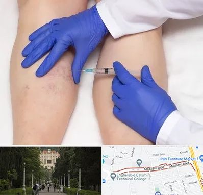 اسکلروتراپی در بلوار معلم رشت 