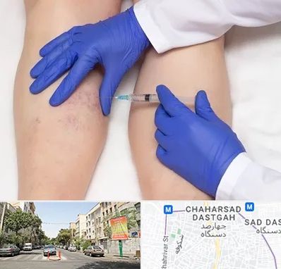 اسکلروتراپی در چهارصد دستگاه 