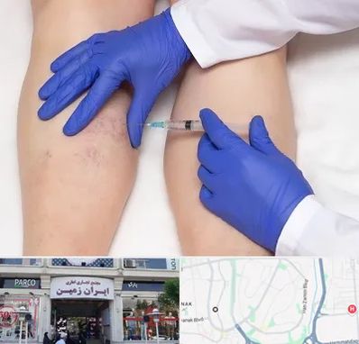 اسکلروتراپی در ایران زمین